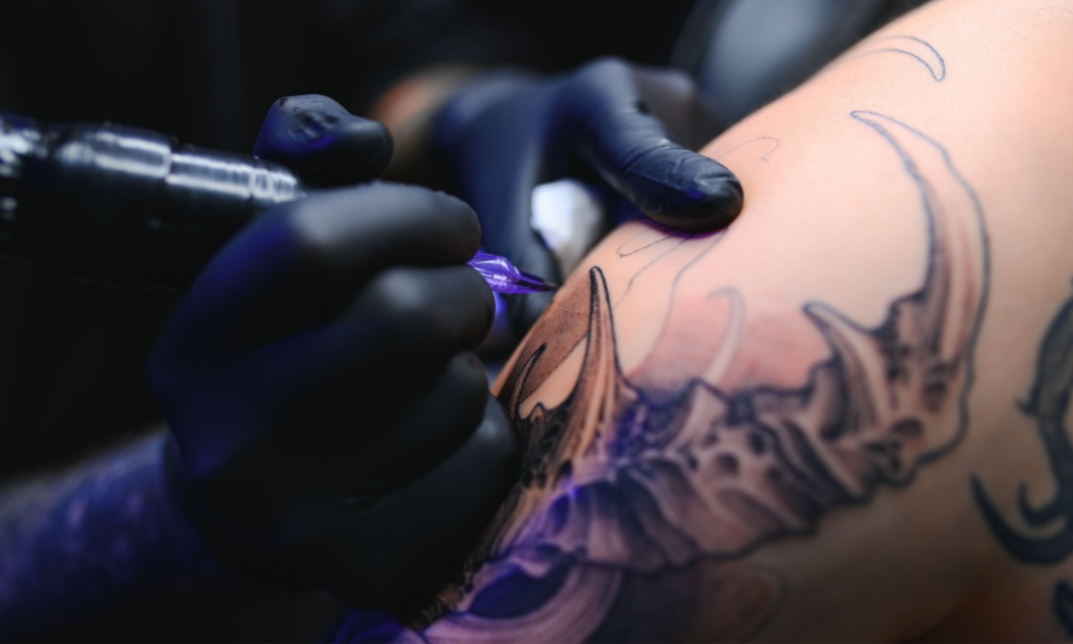 Tattoo Infection Treatment